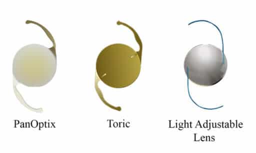 PanOptix, Toric and Light Adjustable Lens IOLs